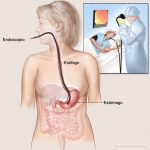 endoscopia digestiva