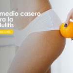 remedio casero para la celulitis