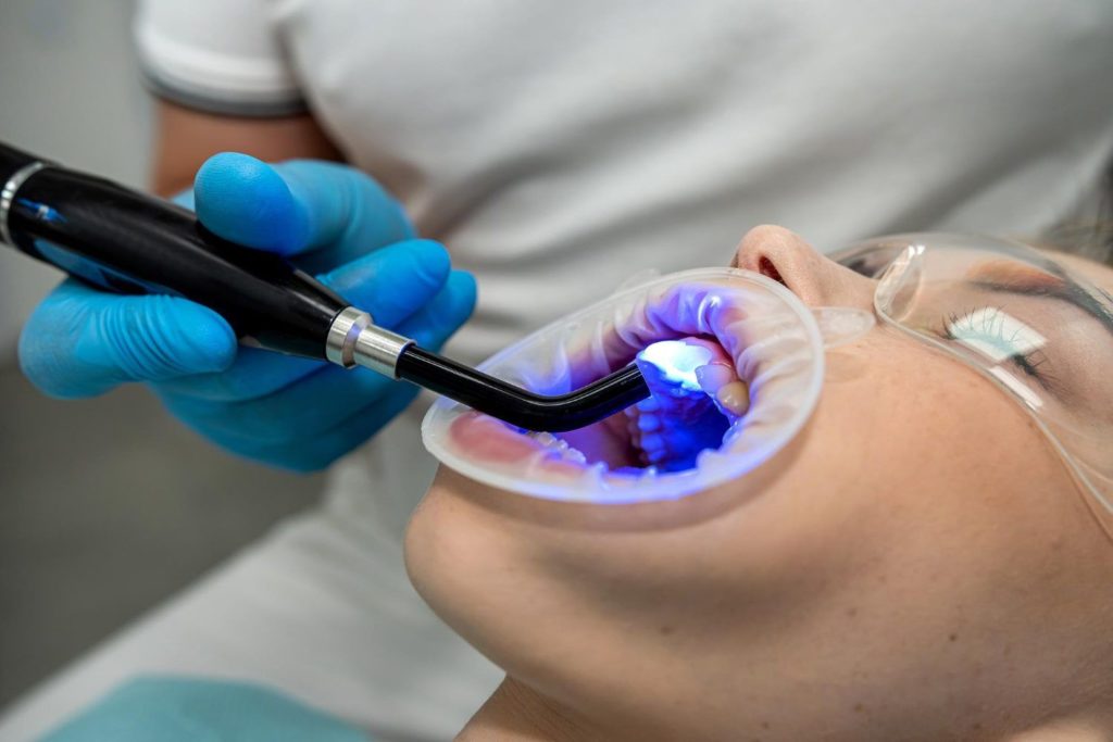 Conoce los Beneficios de las endodoncias