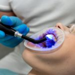 Conoce los Beneficios de las endodoncias