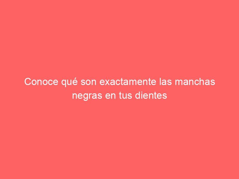 Conoce qué son exactamente las manchas negras en tus dientes