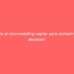 ¿Es el microneedling capilar para combatir la alopecia?